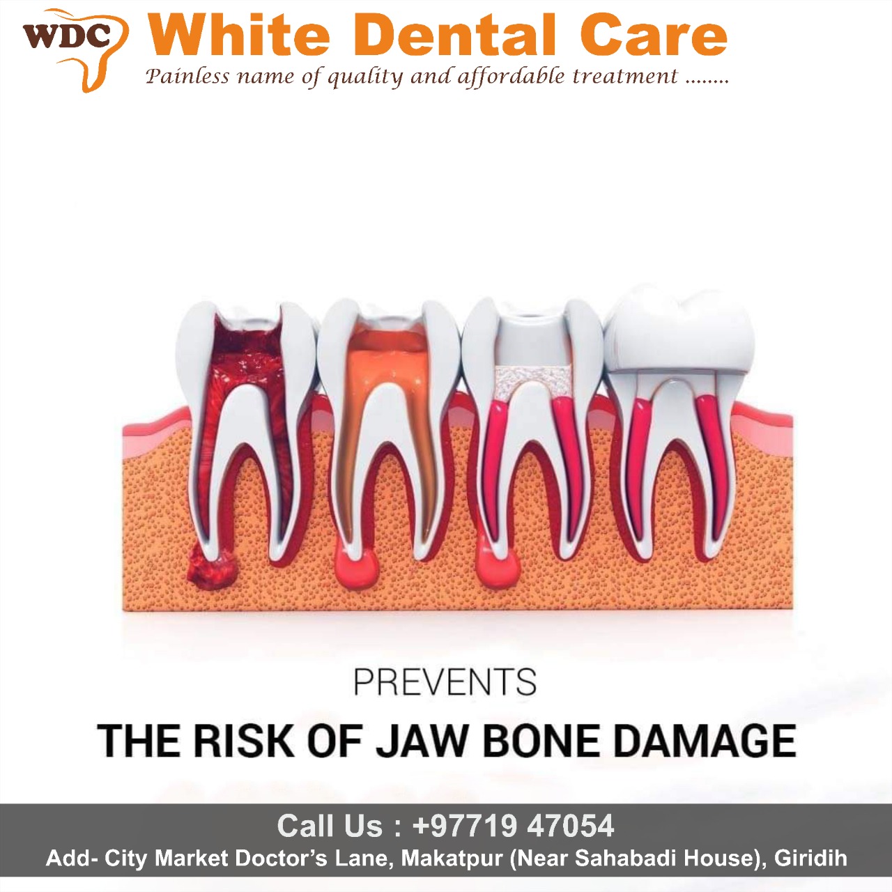 Risk of jaw Bone Damage